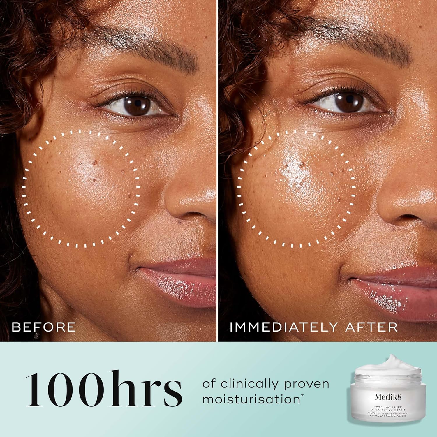 Medik8 Total Moisture Daily Facial Cream – Hyaluronic Acid Moisturiser, Day & Night Face Cream, Clinically Proven Instant, Deep & Lasting Moisturisation, Fragrance-Free For All Skin Types – 50 ml