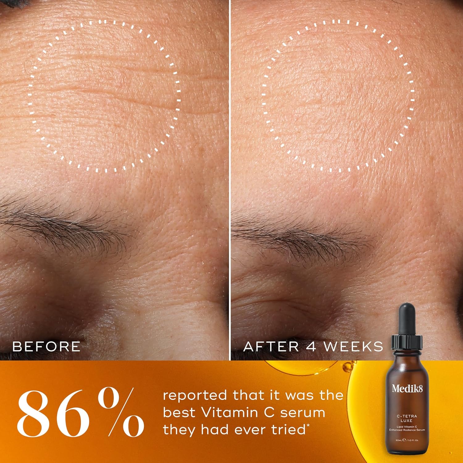 Medik8 C-Tetra Luxe - Lipid 14% Vitamin C Enhanced Radiance Serum -Smooths Fine Lines & Uneven Tone - Antioxidant & Nourishing - Dull, Dry Skin Types - 30ml