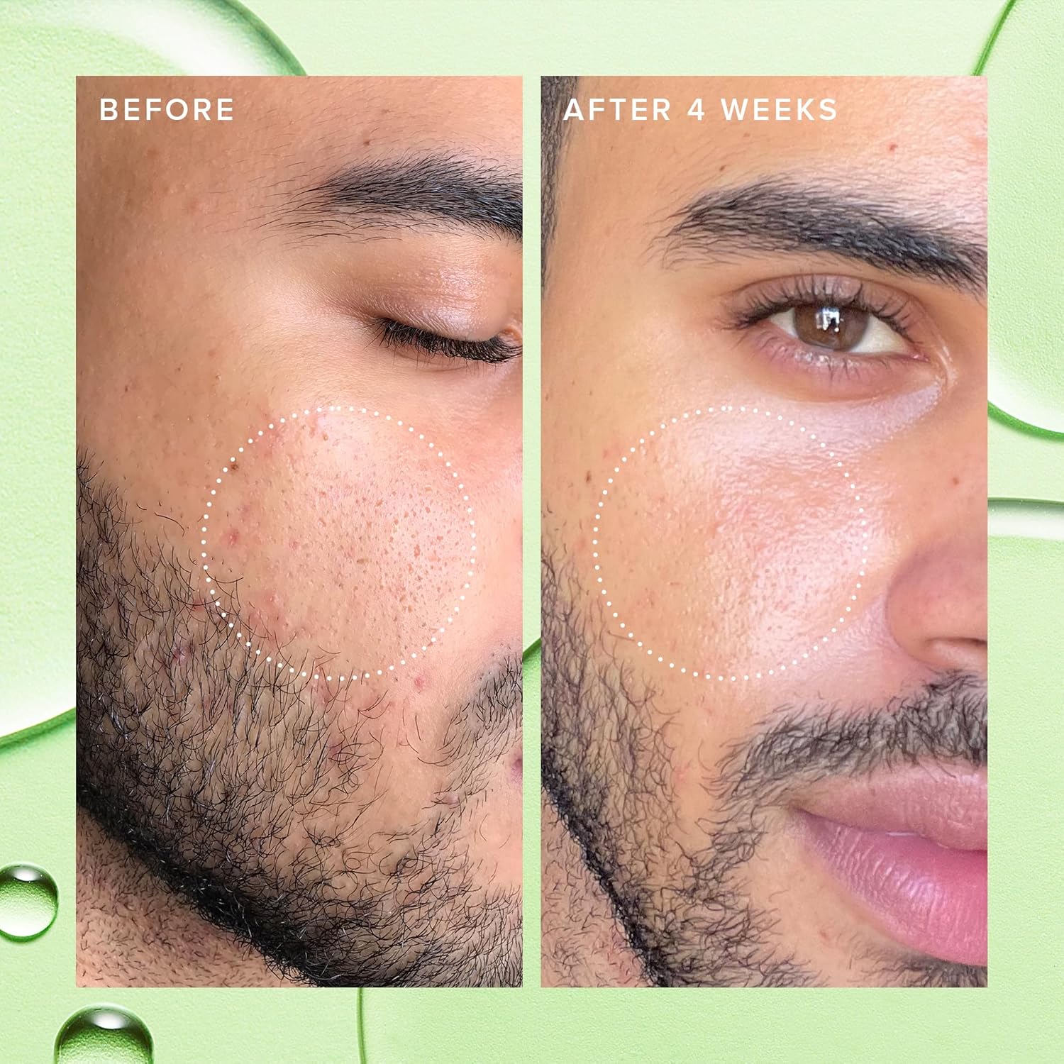Farmacy Deep Sweep 2% BHA Toner for Face - Pore Cleaner and Facial Exfoliator - Salicylic Acid Face Toner (50ml)